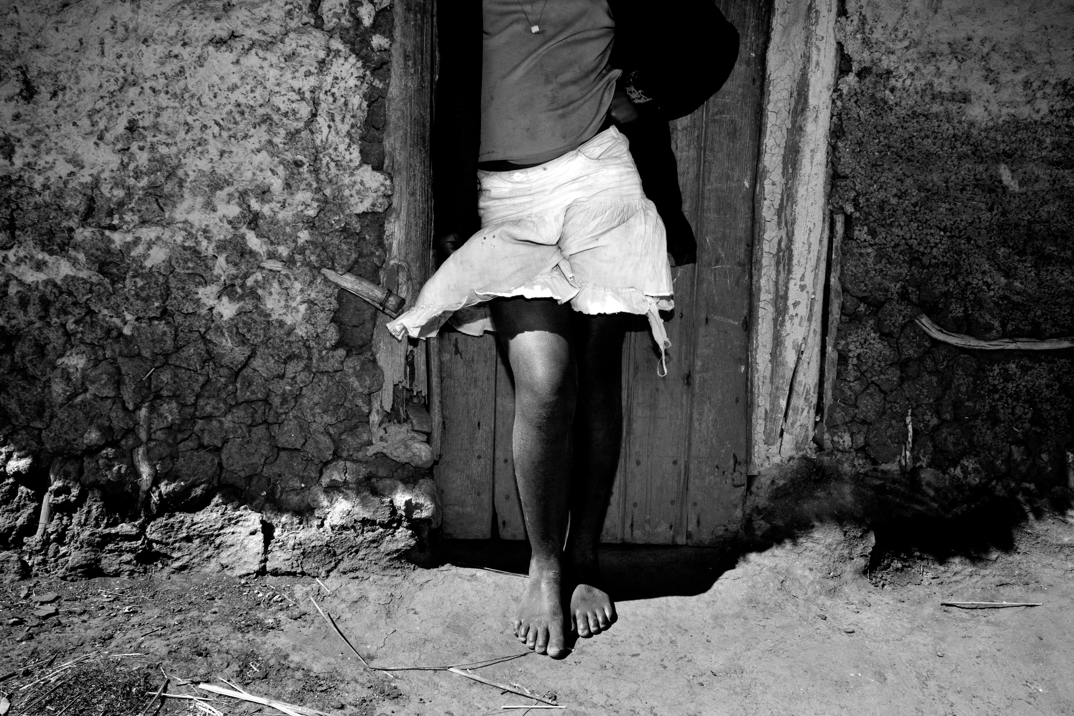 Coming of age for Swazi girls is tough. A tiny African nation of one million people, Swaziland is ruled by one of the world’s last remaining absolute monarchies. Its age-old tradition of polygamy and its relaxed attitude toward sexuality have met in a devastating combination for young girls. Swaziland reports the highest percentage of HIV-positive people in the world, with the hardest hit being young women, aged 15-24. It should come as no surprise that these women rarely live past 31. Their coming of age is complicated by issues like HIV/AIDS, poverty, sexual abuse, and rape. In a period of growth that is meant to be joyous and anxious, the discovery of sexuality is, ironically, the greatest threat to their mortality.

A young girl wears a miniskirt in rural Swaziland. Western dress such as miniskirts have been deemed “unSwazi” and used to justify acts of physical abuse against young girls and women.